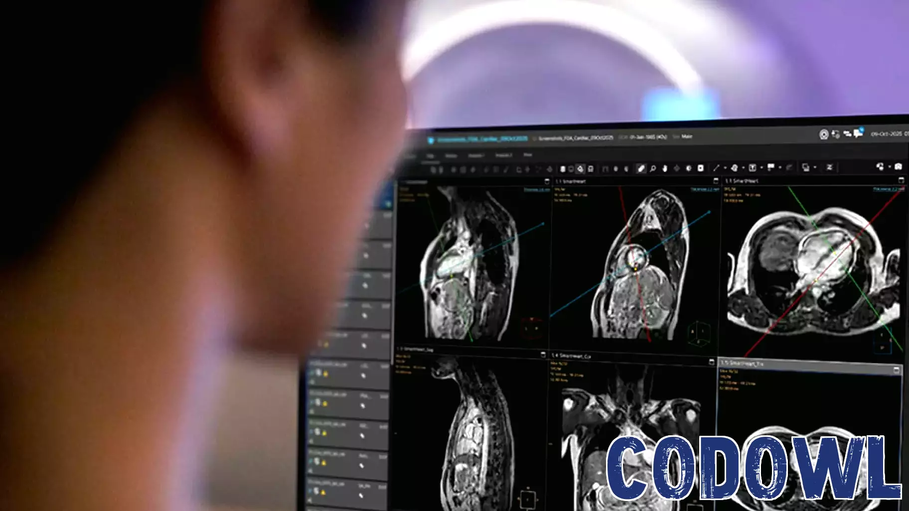 FDA clears AI-enabled cardiac MR planning technology from Philips